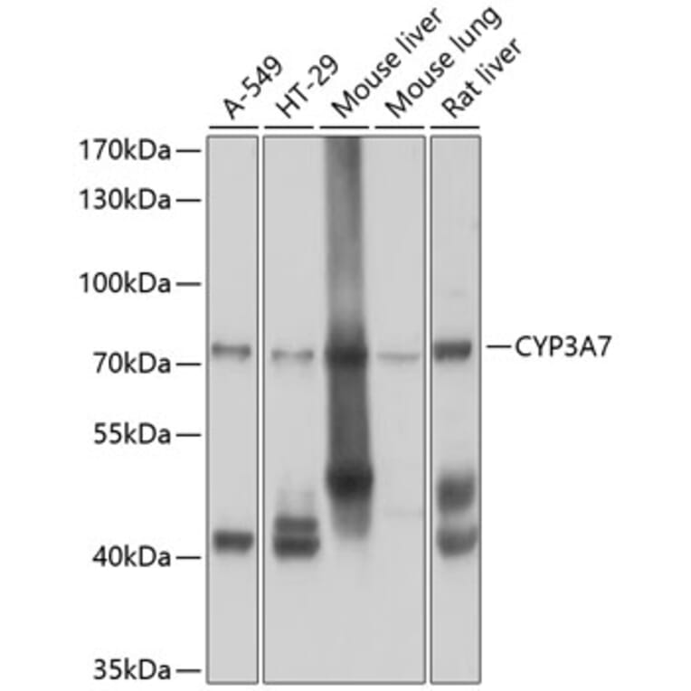 Western Blot - Anti-CYP3A7 Antibody (A10026) - Antibodies.com