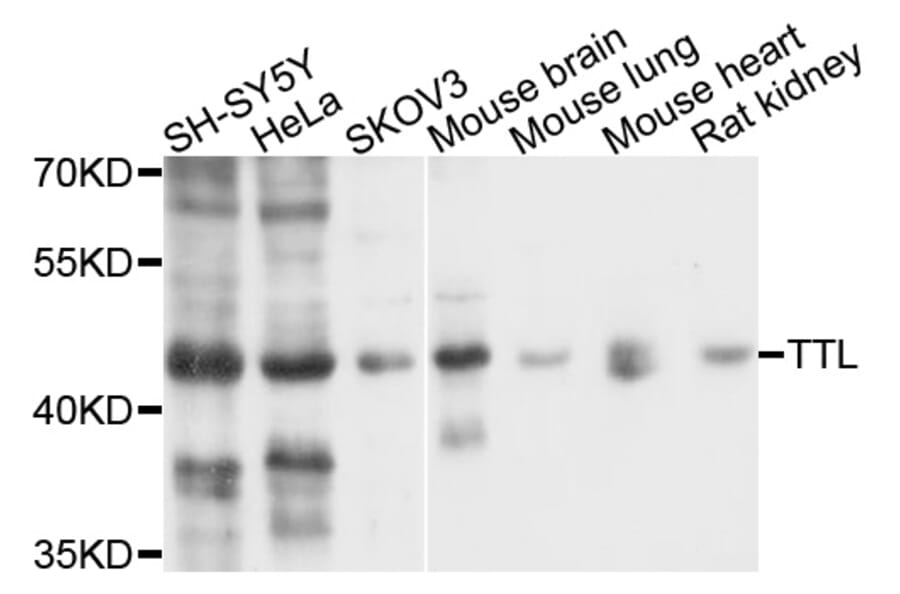 Western Blot - Anti-TTL Antibody (A10027) - Antibodies.com