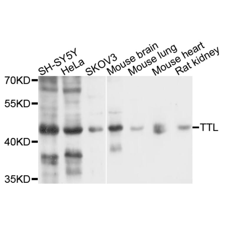 Western Blot - Anti-TTL Antibody (A10027) - Antibodies.com