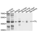 Western Blot - Anti-TTL Antibody (A10027) - Antibodies.com
