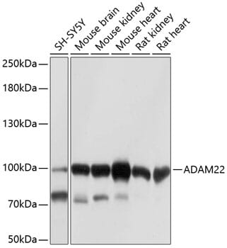 Western blot analysis of extracts of various cell lines, using Anti-ADAM22 Antibody (A10030) at 1:1,000 dilution.
Secondary antibody: Goat Anti-Rabbit IgG (H+L) (HRP) (AS014) at 1:10,000 dilution.
Lysates / proteins: 25µg per lane.
Blocking buffer: 3% non-fat dry milk in TBST.
Detection: ECL Basic Kit (RM00020).
Exposure time: 1s.