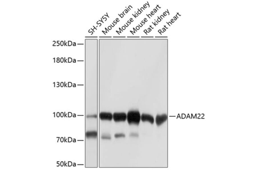 Western Blot - Anti-ADAM22 Antibody (A12766) - Antibodies.com