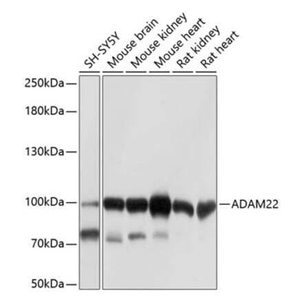 Western Blot - Anti-ADAM22 Antibody (A12766) - Antibodies.com