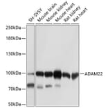 Western Blot - Anti-ADAM22 Antibody (A12766) - Antibodies.com