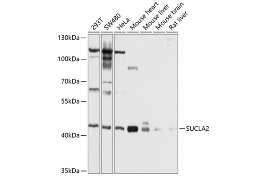 Western Blot - Anti-SUCLA2 Antibody (A12768) - Antibodies.com