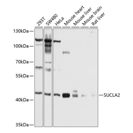 Western Blot - Anti-SUCLA2 Antibody (A12768) - Antibodies.com