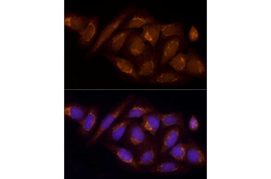 Immunofluorescence - Anti-SUCLA2 Antibody (A12768) - Antibodies.com