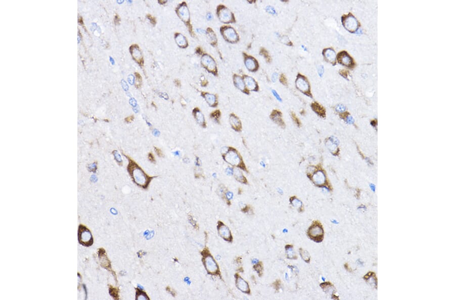 Immunohistochemistry - Anti-RPL8 Antibody (A12769) - Antibodies.com