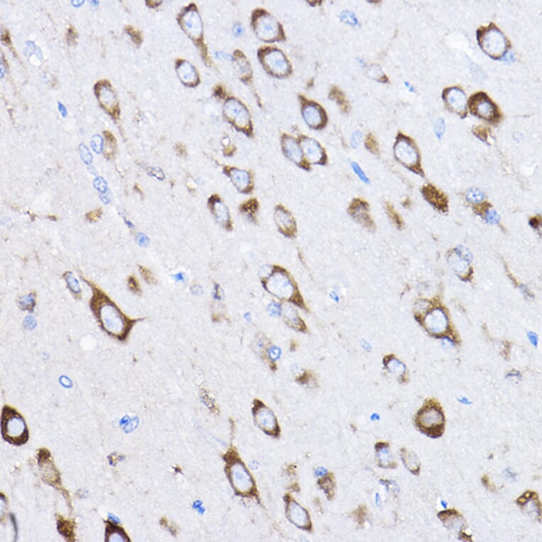 Immunohistochemistry - Anti-RPL8 Antibody (A12769) - Antibodies.com