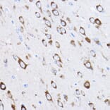 Immunohistochemistry - Anti-RPL8 Antibody (A12769) - Antibodies.com