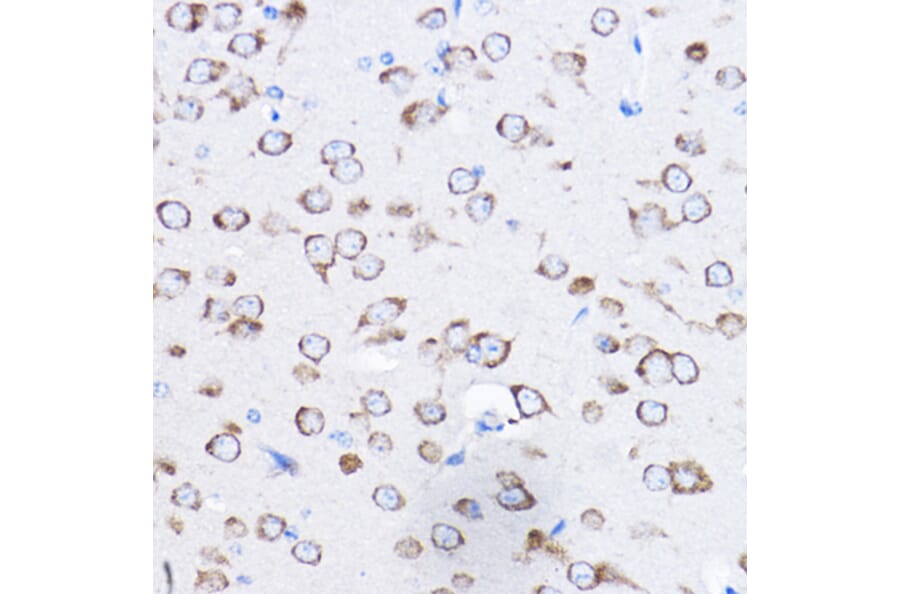 Immunohistochemistry - Anti-RPL8 Antibody (A12769) - Antibodies.com