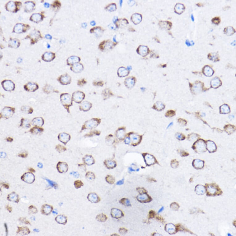 Immunohistochemistry - Anti-RPL8 Antibody (A12769) - Antibodies.com