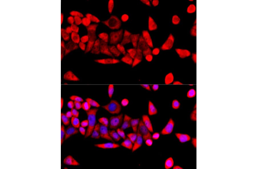 Immunofluorescence - Anti-RPL8 Antibody (A12769) - Antibodies.com
