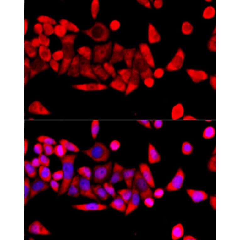 Immunofluorescence - Anti-RPL8 Antibody (A12769) - Antibodies.com