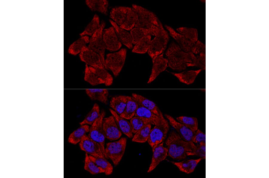Immunofluorescence - Anti-RPL8 Antibody (A12769) - Antibodies.com