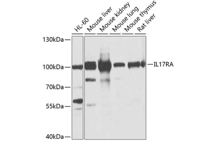 Western Blot - Anti-IL-17 RA Receptor Antibody (A12771) - Antibodies.com