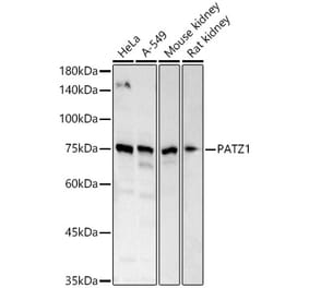 Western Blot - Anti-PATZ1 Antibody (A12772) - Antibodies.com