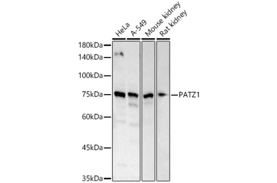 Western Blot - Anti-PATZ1 Antibody (A12772) - Antibodies.com