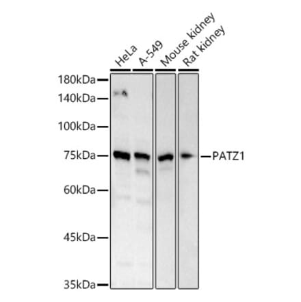 Western Blot - Anti-PATZ1 Antibody (A12772) - Antibodies.com