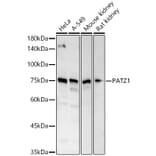 Western Blot - Anti-PATZ1 Antibody (A12772) - Antibodies.com