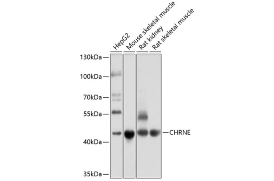 Western Blot - Anti-Nicotinic Acetylcholine Receptor epsilon/CHRNE Antibody (A12773) - Antibodies.com