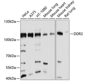 Western Blot - Anti-DDR2 Antibody (A12774) - Antibodies.com