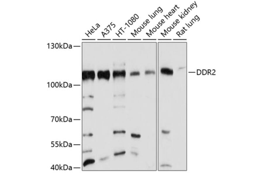 Western Blot - Anti-DDR2 Antibody (A12774) - Antibodies.com
