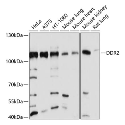 Western Blot - Anti-DDR2 Antibody (A12774) - Antibodies.com