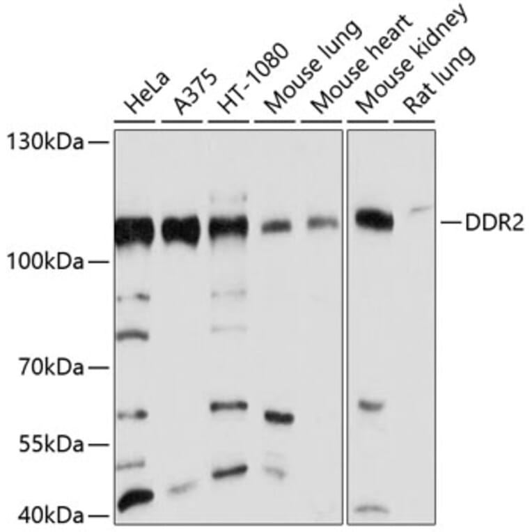 Western Blot - Anti-DDR2 Antibody (A12774) - Antibodies.com