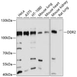 Western Blot - Anti-DDR2 Antibody (A12774) - Antibodies.com