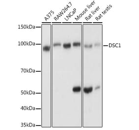 Western Blot - Anti-Desmocollin 1 Antibody (A12775) - Antibodies.com