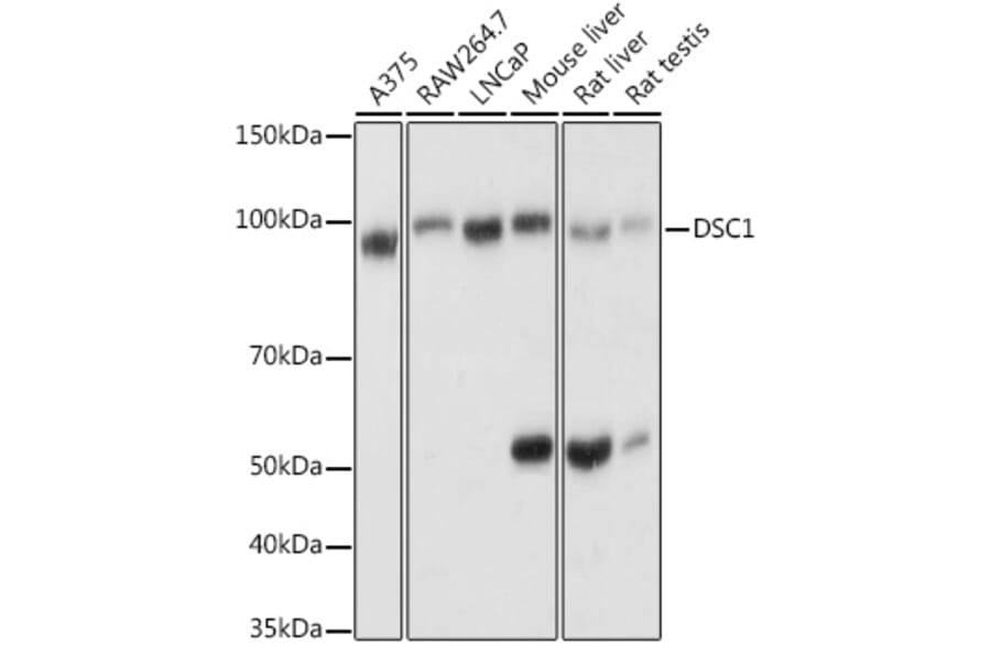 Western Blot - Anti-Desmocollin 1 Antibody (A12775) - Antibodies.com