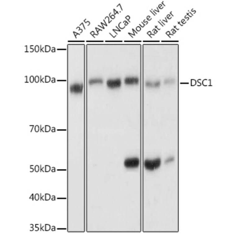 Western Blot - Anti-Desmocollin 1 Antibody (A12775) - Antibodies.com