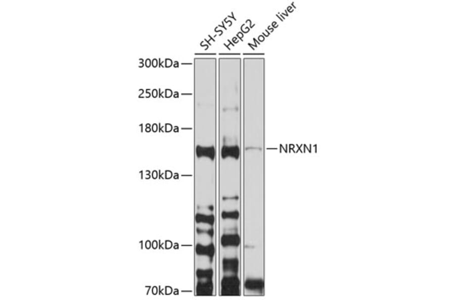 Western Blot - Anti-Neurexin 1 Antibody (A12776) - Antibodies.com