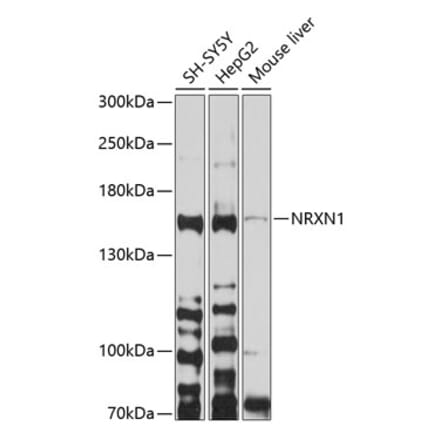 Western Blot - Anti-Neurexin 1 Antibody (A12776) - Antibodies.com