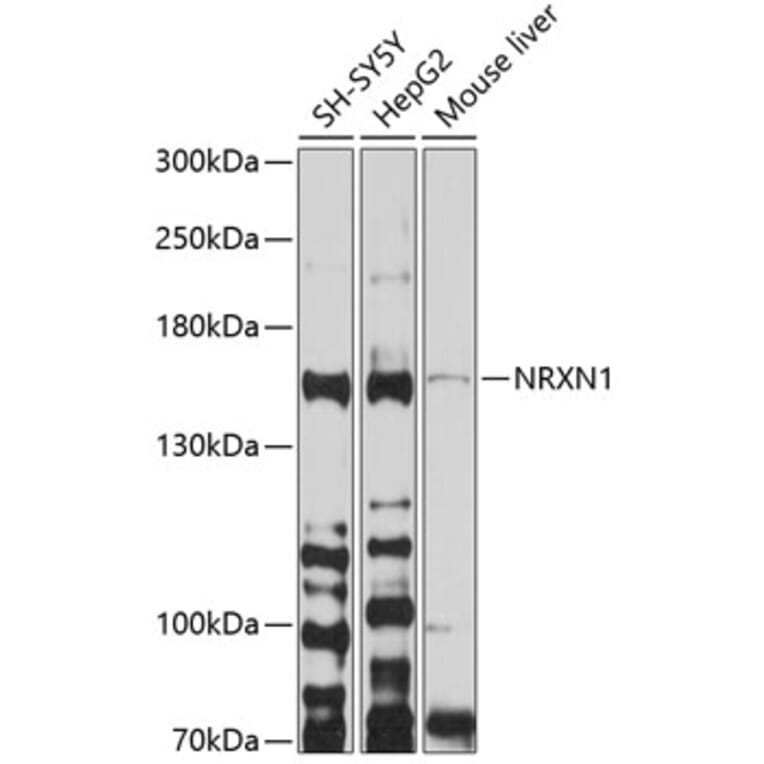 Western Blot - Anti-Neurexin 1 Antibody (A12776) - Antibodies.com