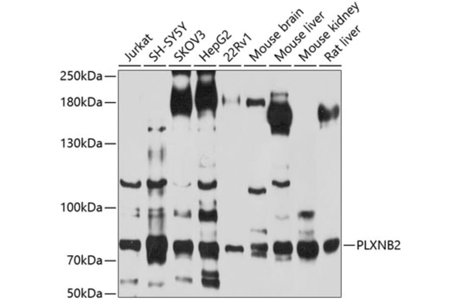 Western Blot - Anti-Plexin B2/MM1 Antibody (A12777) - Antibodies.com