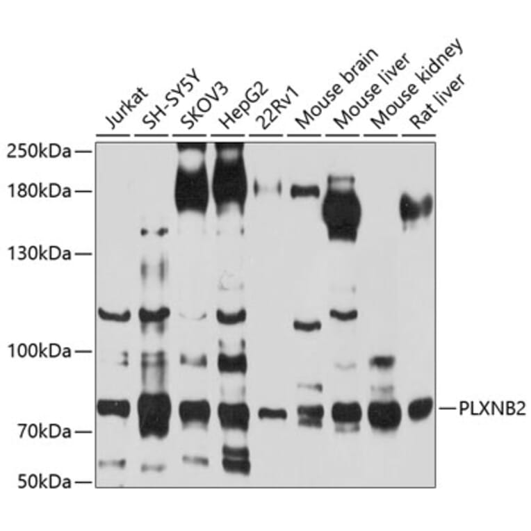 Western Blot - Anti-Plexin B2/MM1 Antibody (A12777) - Antibodies.com