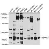 Western Blot - Anti-Plexin B2/MM1 Antibody (A12777) - Antibodies.com