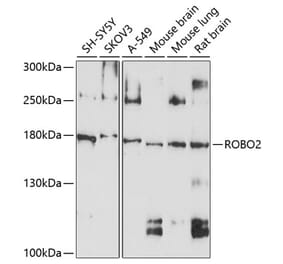 Western Blot - Anti-Robo2 Antibody (A12778) - Antibodies.com