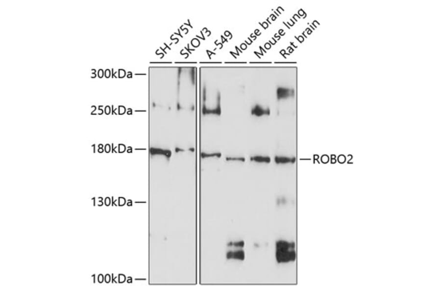 Western Blot - Anti-Robo2 Antibody (A12778) - Antibodies.com