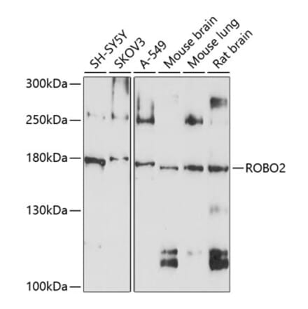 Western Blot - Anti-Robo2 Antibody (A12778) - Antibodies.com