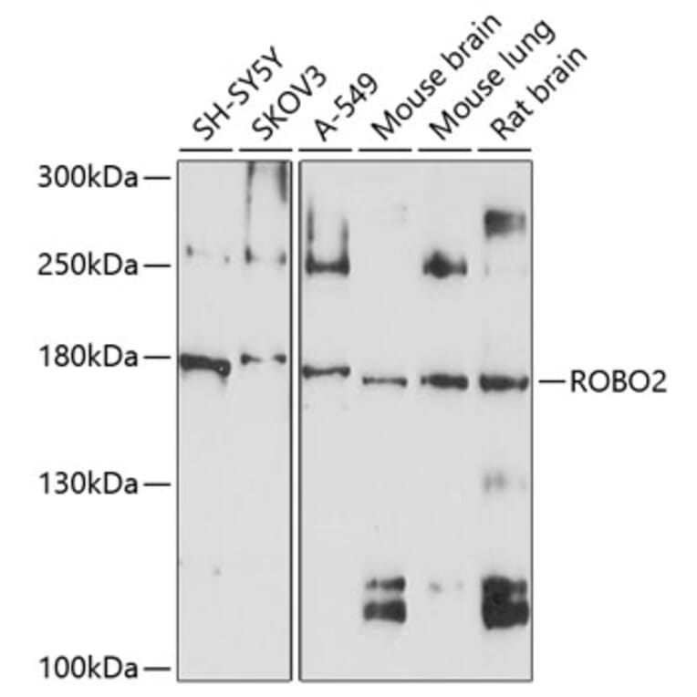 Western Blot - Anti-Robo2 Antibody (A12778) - Antibodies.com