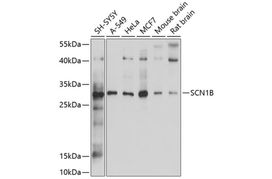 Western Blot - Anti-SCN1B Antibody (A12779) - Antibodies.com