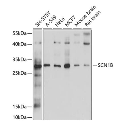 Western Blot - Anti-SCN1B Antibody (A12779) - Antibodies.com