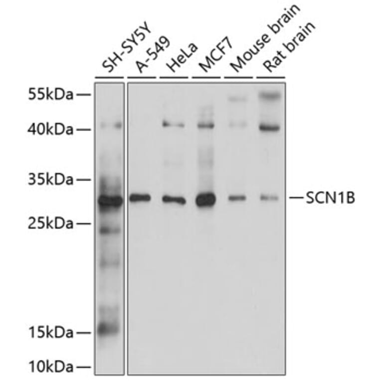 Western Blot - Anti-SCN1B Antibody (A12779) - Antibodies.com