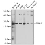 Western Blot - Anti-SCN1B Antibody (A12779) - Antibodies.com