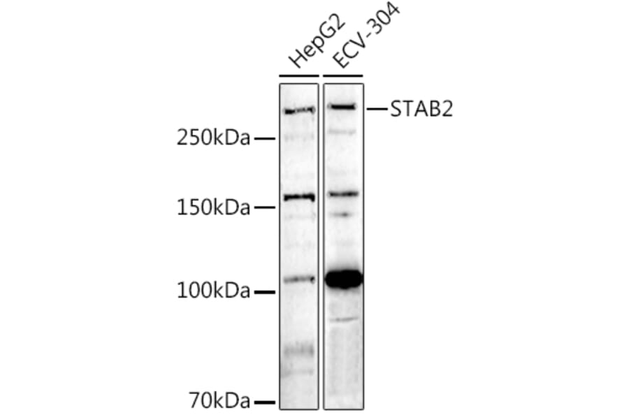 Western Blot - Anti-Stabilin 2 Antibody (A12780) - Antibodies.com