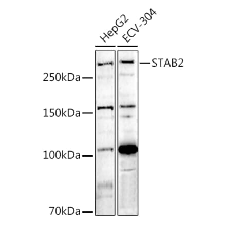 Western Blot - Anti-Stabilin 2 Antibody (A12780) - Antibodies.com