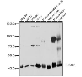 Western Blot - Anti-DAG1 Antibody (A12781) - Antibodies.com